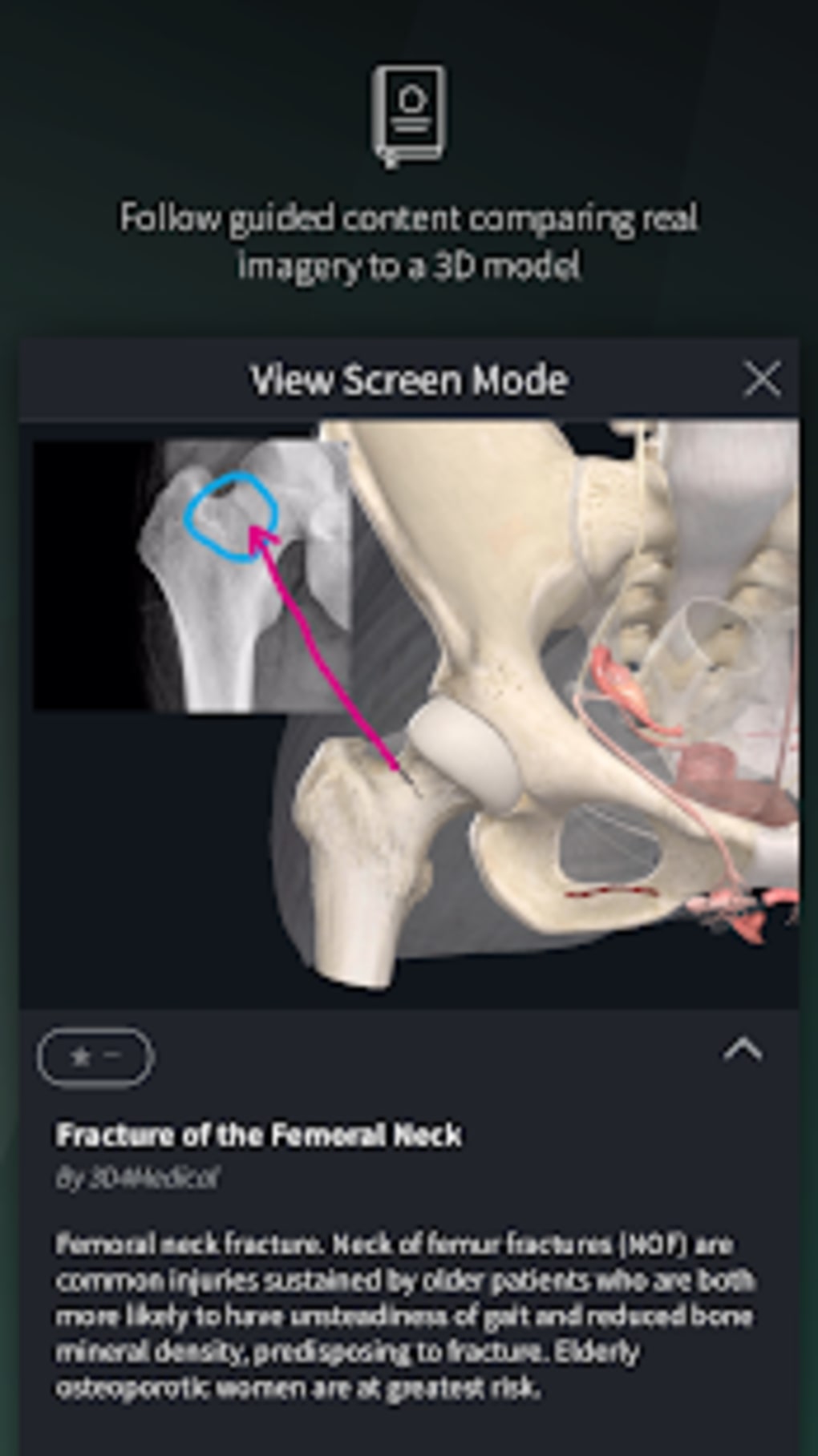 complete anatomy app