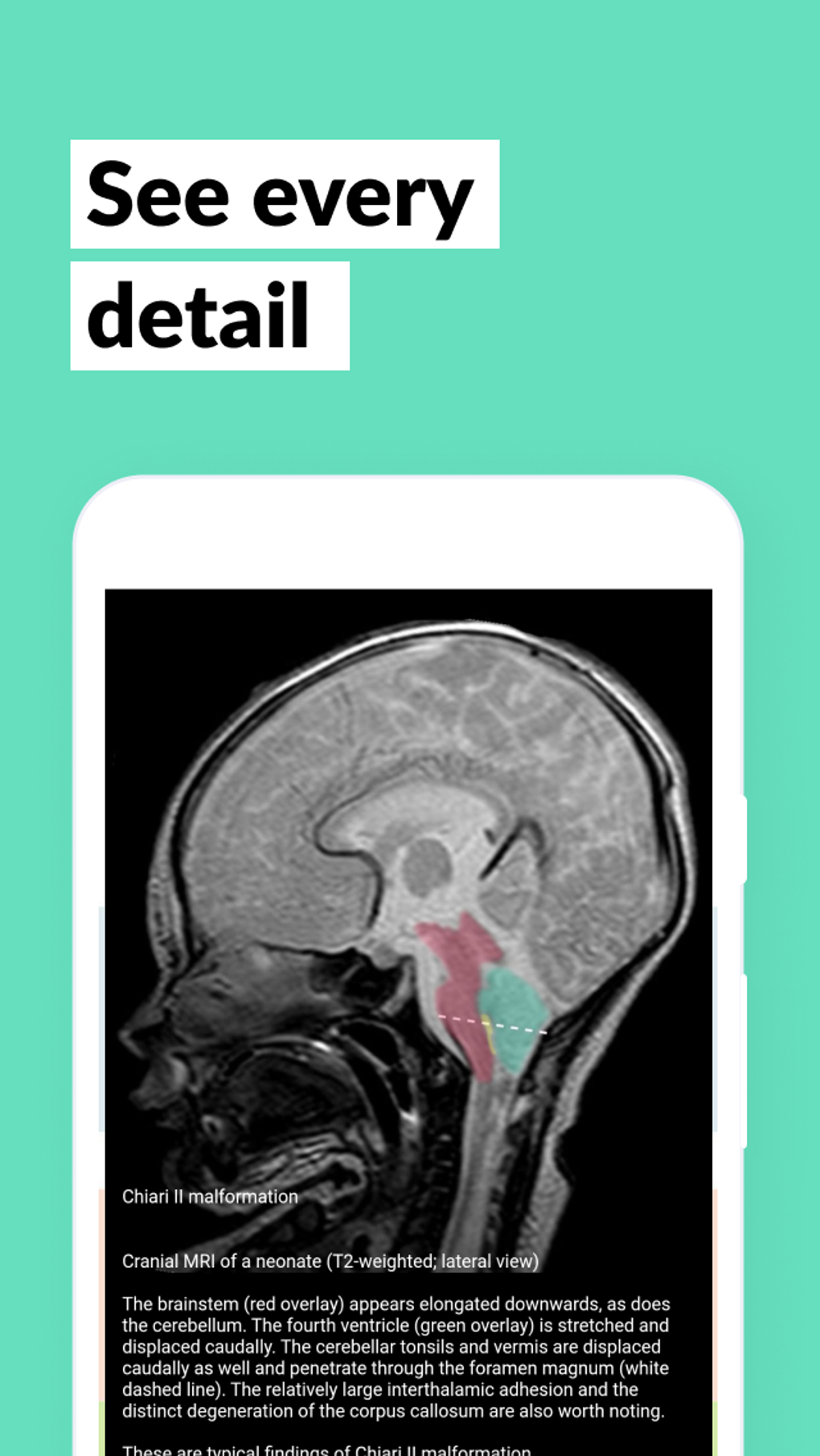 AMBOSS Medical Exam Qbank: USMLE Step NBME Shelf APK for Android - Download