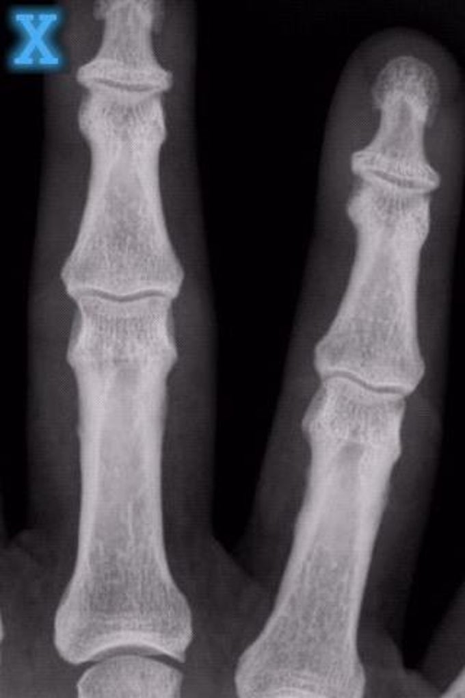 X-Ray Scanner X-Ray Scanner