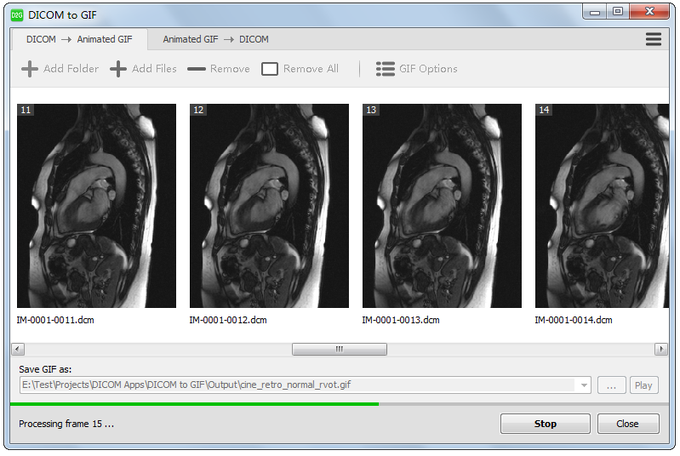 DICOM to GIF DICOM to GIF