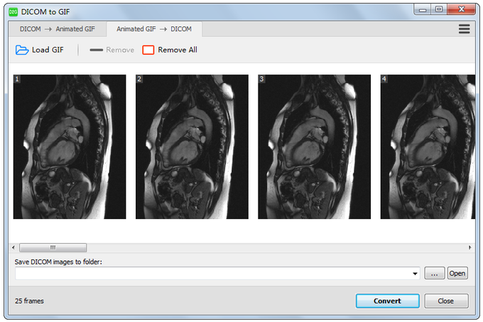 DICOM to GIF DICOM to GIF