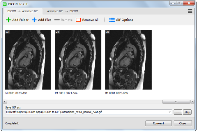 DICOM to GIF DICOM to GIF