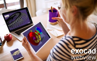 exocad webview