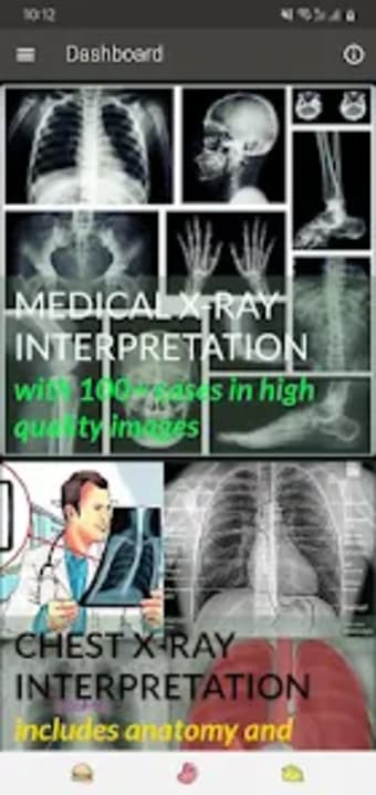 Medical X-RAY Interpretations