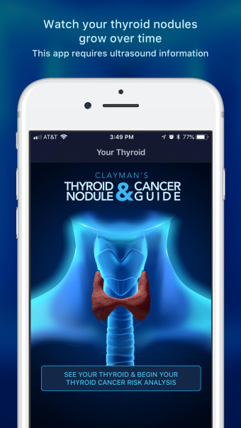 Thyroid Nodule  Cancer Guide