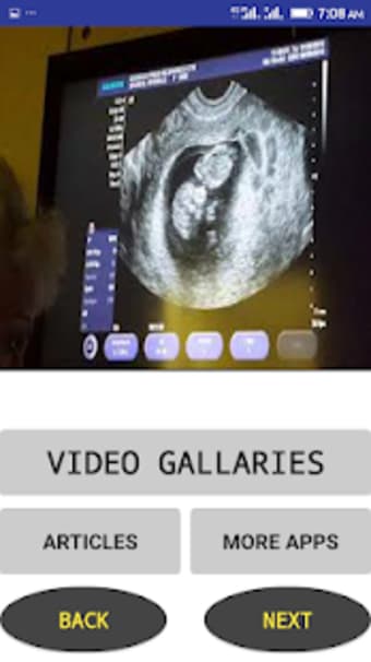 Ultrasound Video
