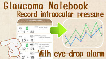 Glaucoma notebook -IOP note