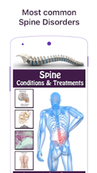 Spine Diseases  Treatment
