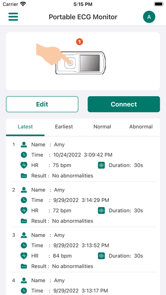 EMAY Portable ECG Monitor