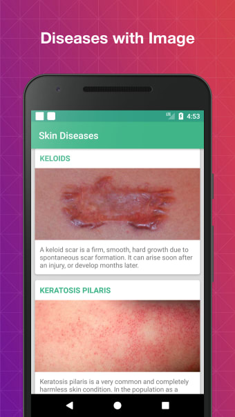 Skin Diseases and Treatments