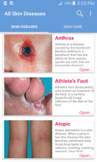 Skin diseases and treatment of