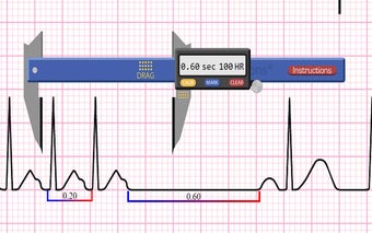 Apex EKG Caliper