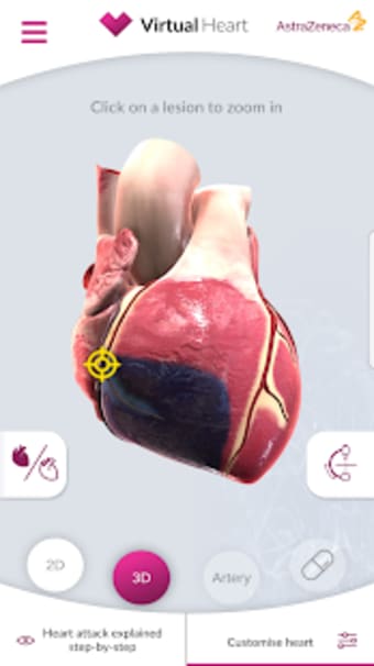 Virtual Heart - ANZ