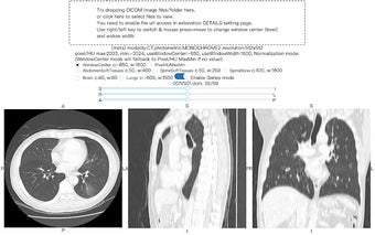 DICOM image viewer