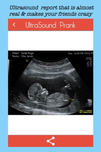 Baby Ultrasound spoof