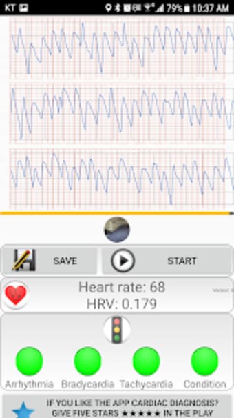 Cardiac diagnosis heart rate arrhythmia