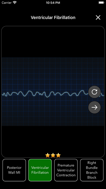 ECG Test Pro for Doctors