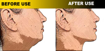 Jaw Muscles Exercises - Redefine Your JawLine