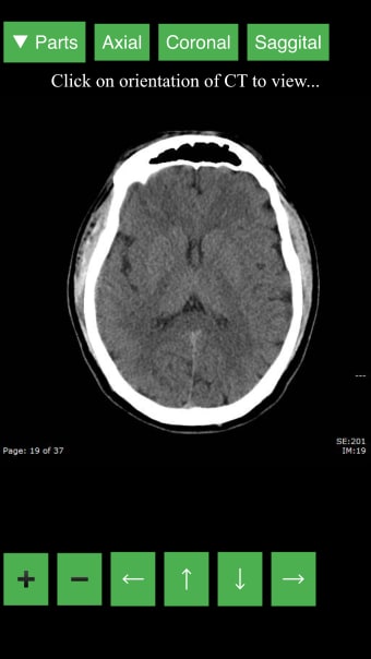 Radiology CT Viewer
