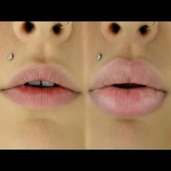 Large Lips