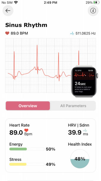 ECG heart analyze - watch