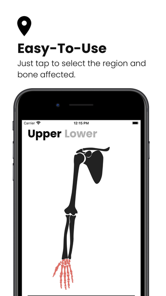 Fractures: Splinting App