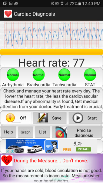 Heart Diagnosis
