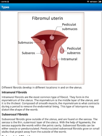 Uterine Fibroid Treatment Help
