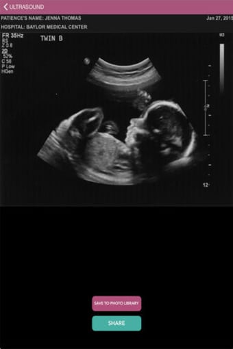 Baby Ultrasound 2015
