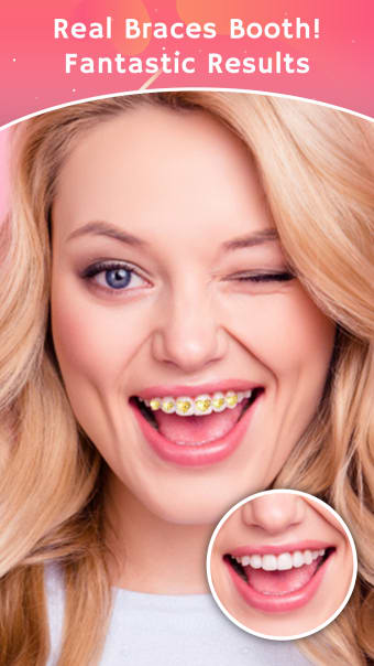 Teeth Braces Photo Maker- Braces Camera Editor