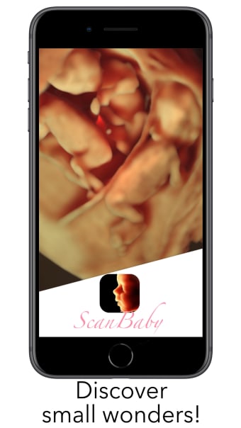 ScanBaby learn baby ultrasound