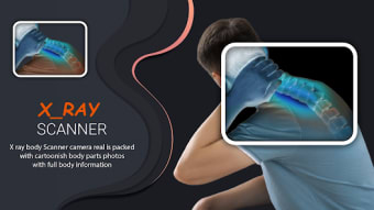 Xray body scanner doctor games