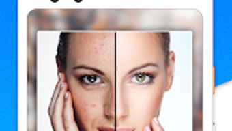 Изображение 0 для 