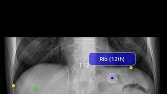 Xray Anatomy