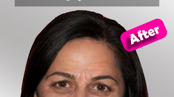 Bild 0 för 
