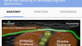 Regional Anesthesia Reference