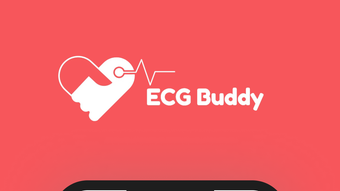 ECG Buddy