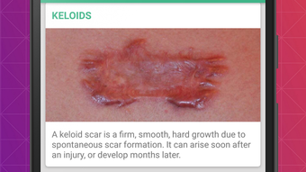 Skin Diseases and Treatments