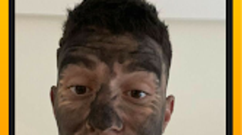 의 이미지 0