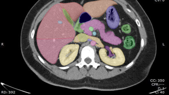 Anatomy on Radiology CT