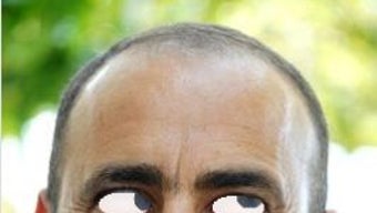 Imagem 0 para 