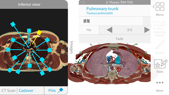 Human Anatomy Atlas 2021: Complete 3D Human Body