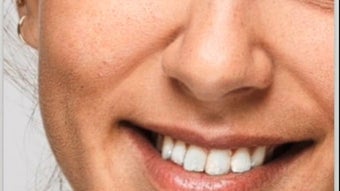  için 0 numaralı resim