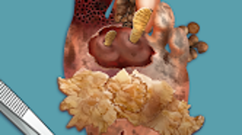  için 0 numaralı resim