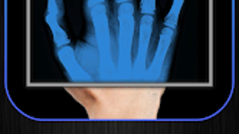 รูปภาพ 0 สำหรับ 