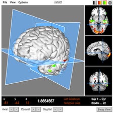 MRI Scalar