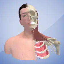 3D Cervical Dystonia