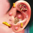 程序图标：Ear Cleaning Games: EAR D…
