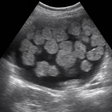 程序图标：ARRT Ultrasound Cards Lit…
