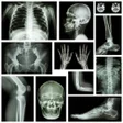 Programikonen: Medical X-RAY Interpretat…